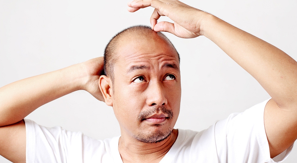 Learn how to prevent hair loss