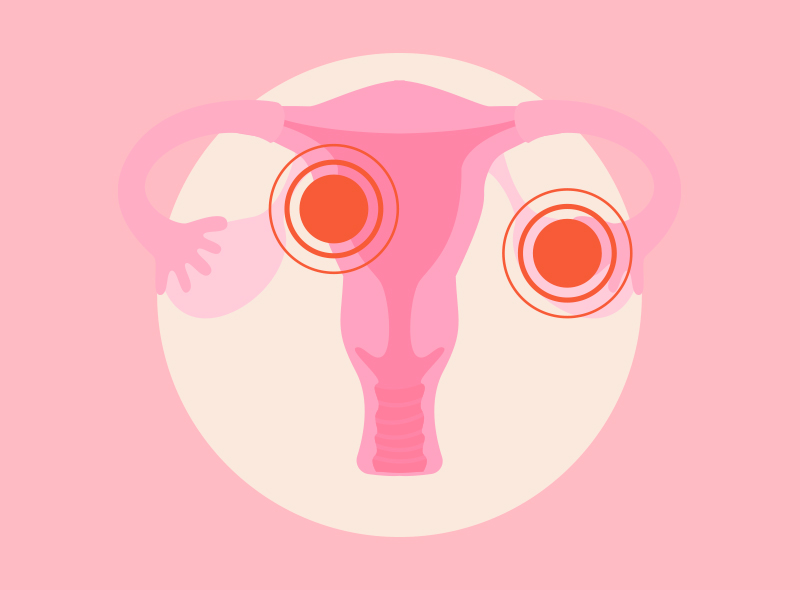 Birth control pills reduce the risk of cancer
